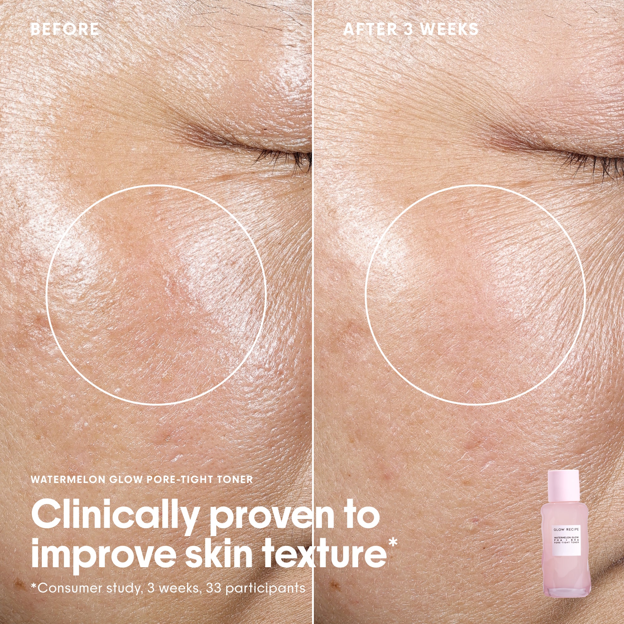 The Korean Glass Skincare Vault Kit - Image 5