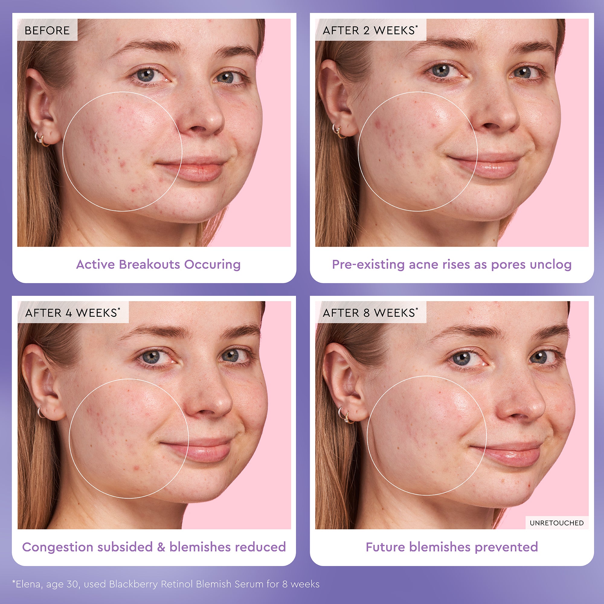 Blackberry Retinol Blemish Serum - Image 4